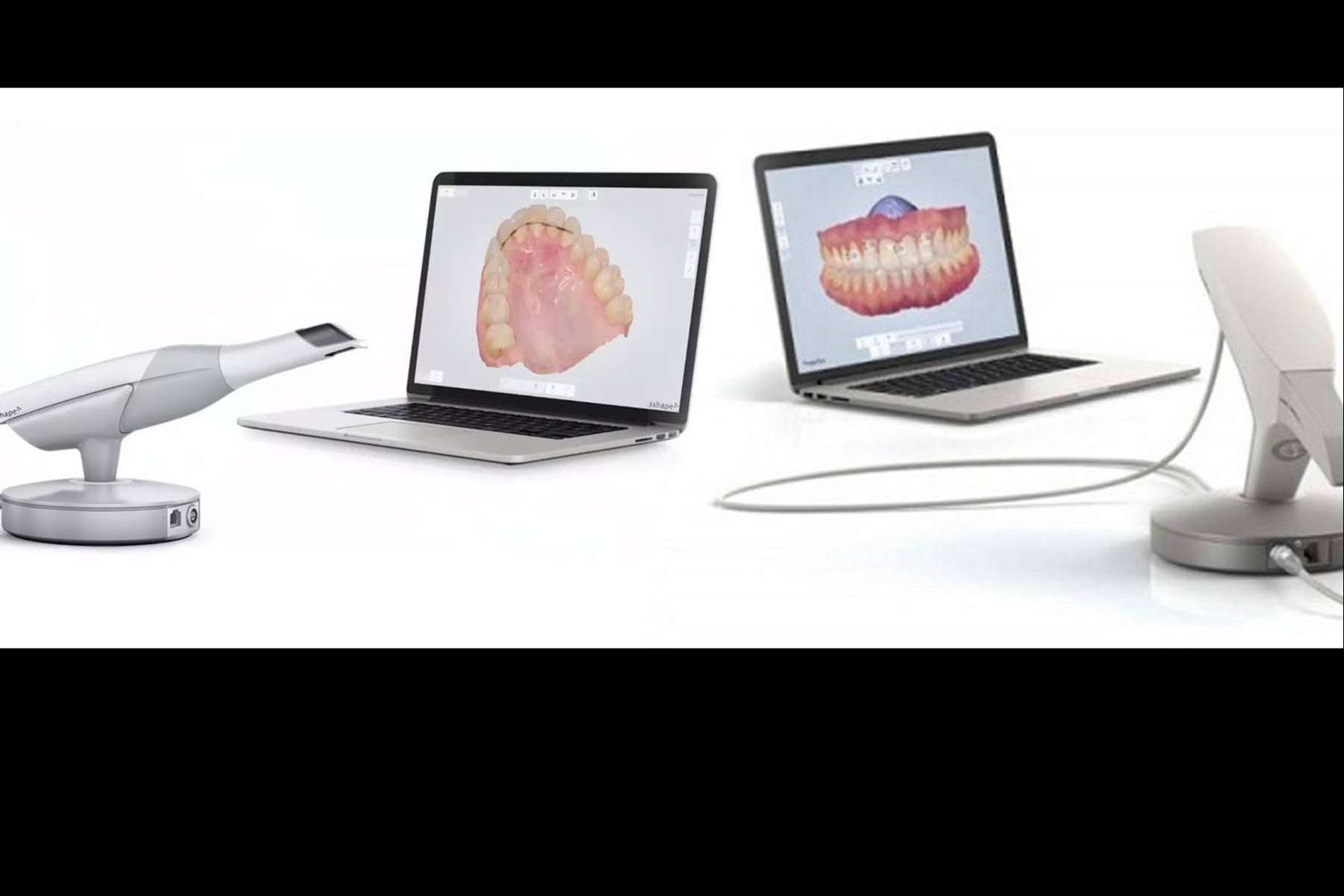 La clínica dental Implant Clinics realiza la toma de registros con 3Shape TRIOS, un escáner de última tecnología