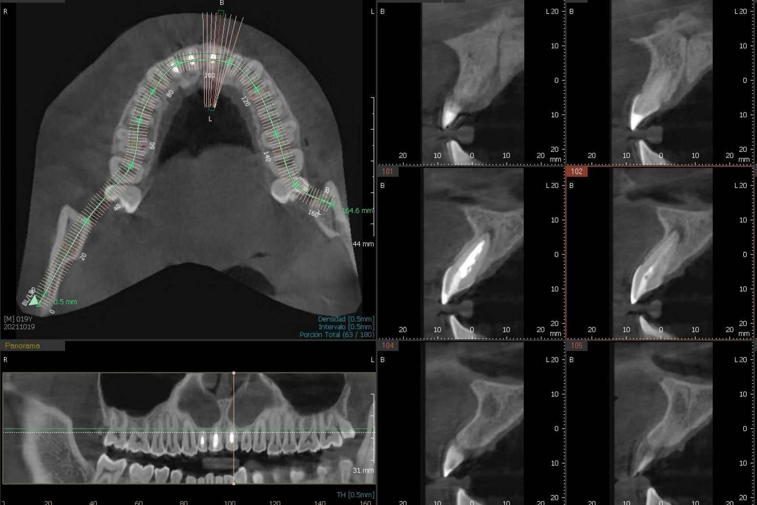El innovador CBCT dental 3D que ofrece la Clínica Blay+Monzó