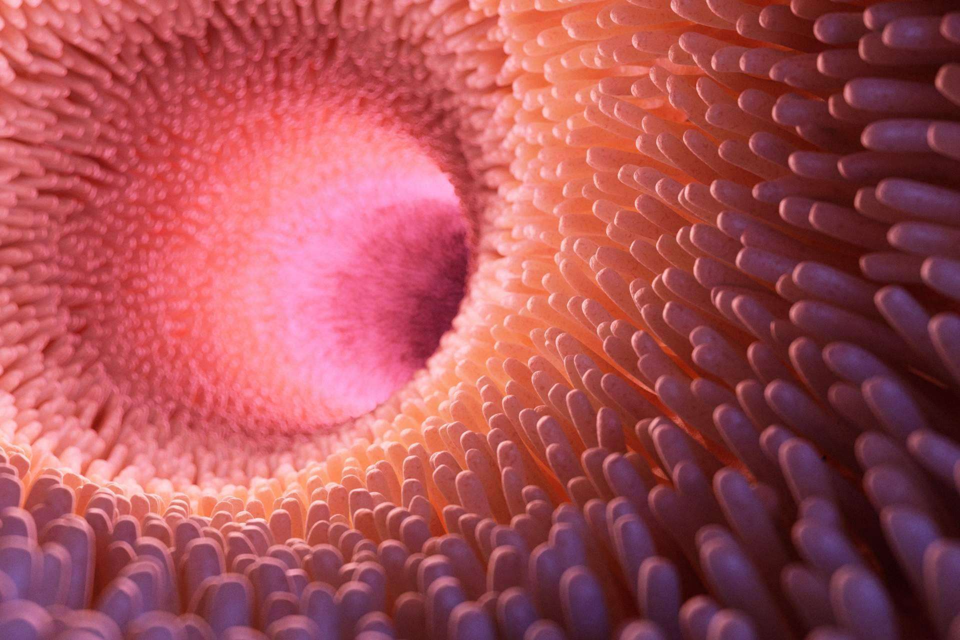¿Existe tratamiento para la disbiosis intestinal?