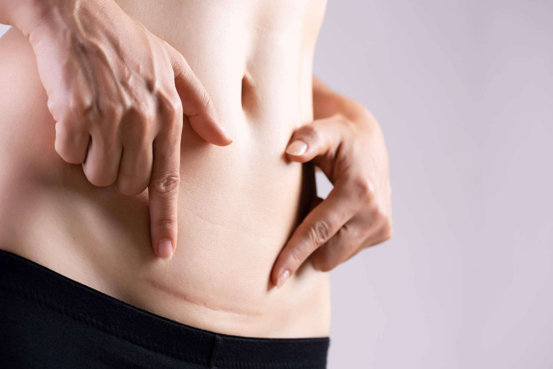 Los beneficios de la fisioterapia y la osteopatía en el tratamiento de cicatrices y liberación de adherencias