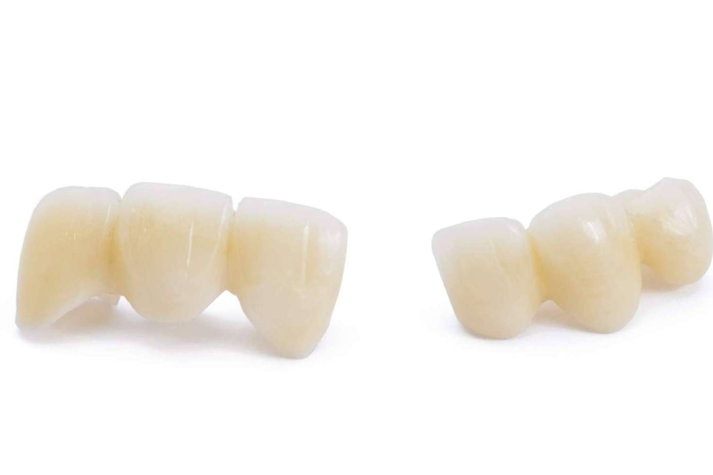 Coronas dentarias impresas con tecnología 3D en una hora de la mano de Dentinova