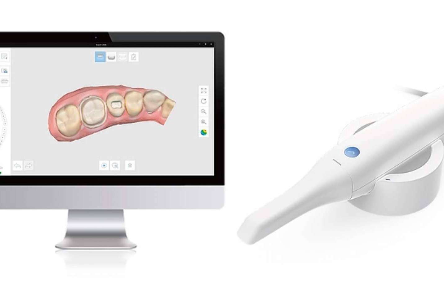 No más pastas en la boca con la tecnología 3D y el escáner oral