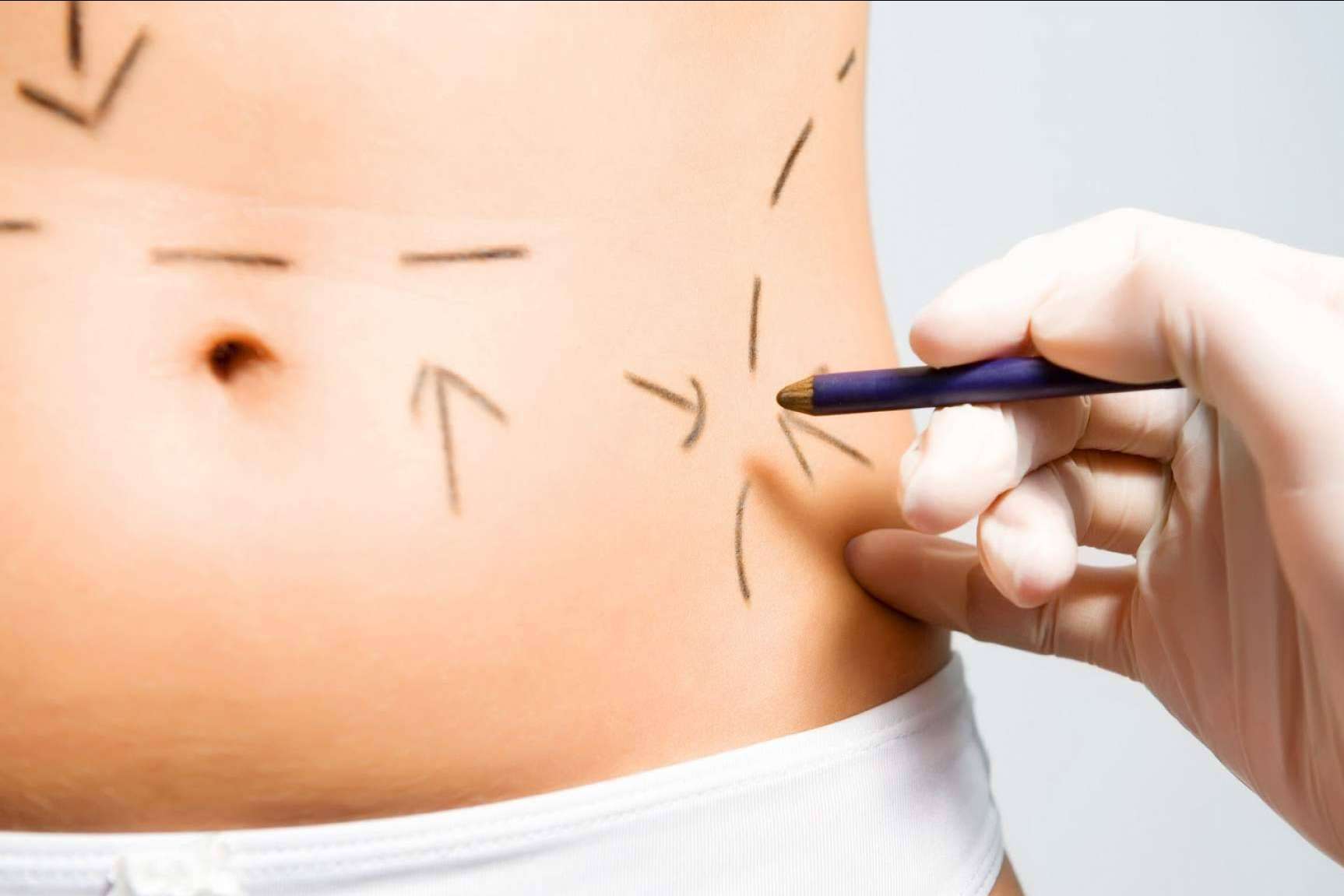 Lucir un cuerpo soñado gracias a la cirugía estética corporal de Clínicas Be