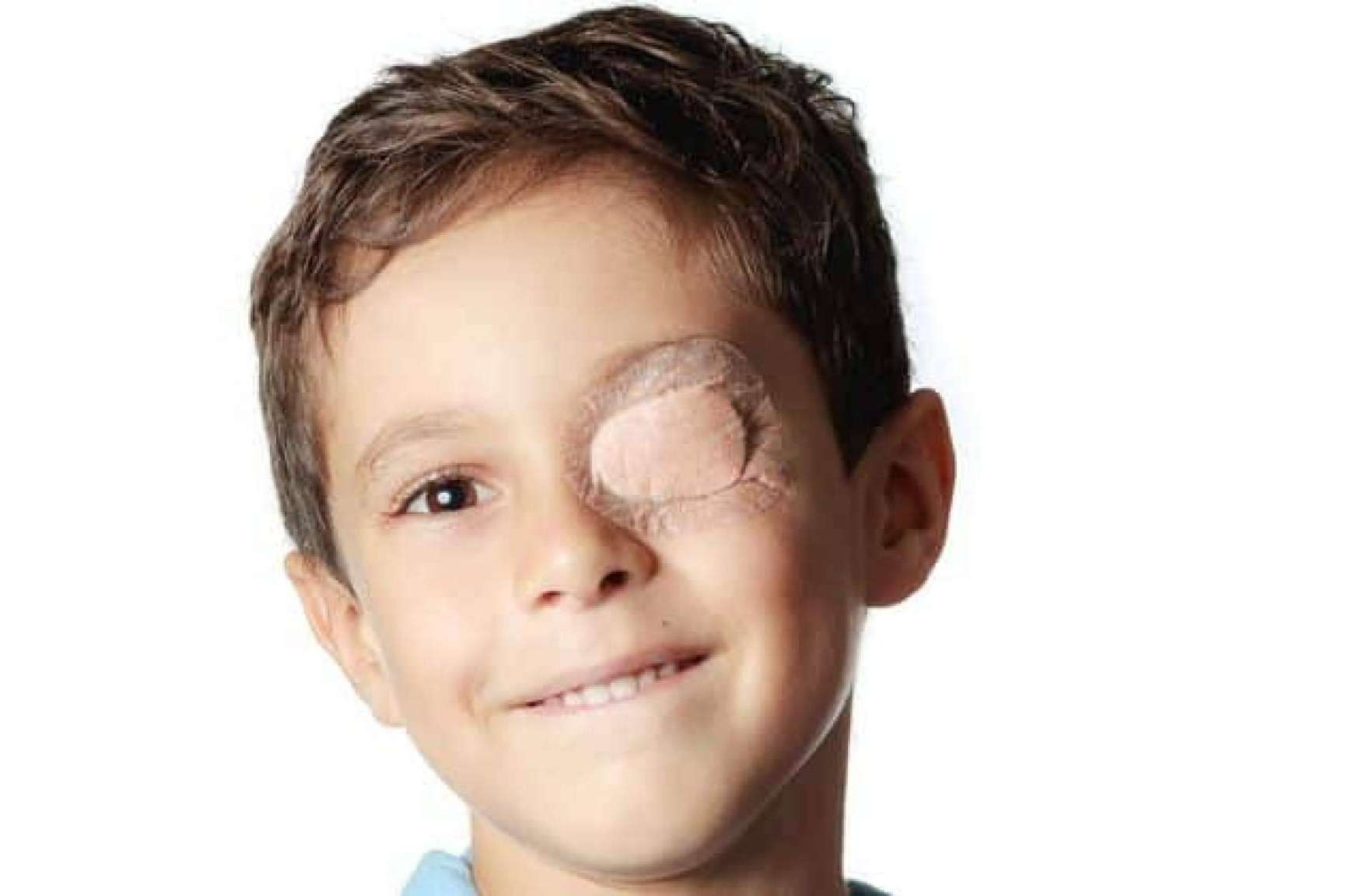 Los nuevos tratamientos de Dicopt para curar el ojo vago