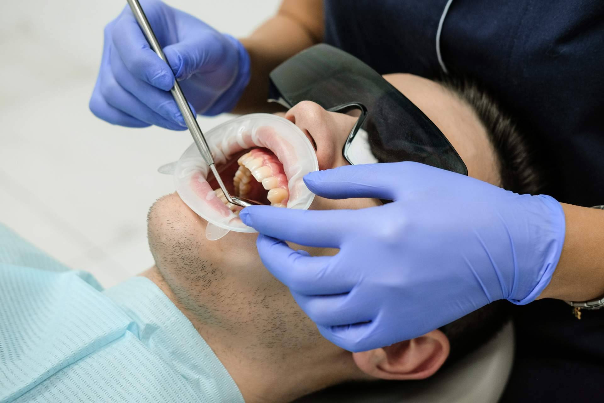¿Qué es y en qué consiste una endodoncia?, Implant Clinics resuelve las dudas al respecto