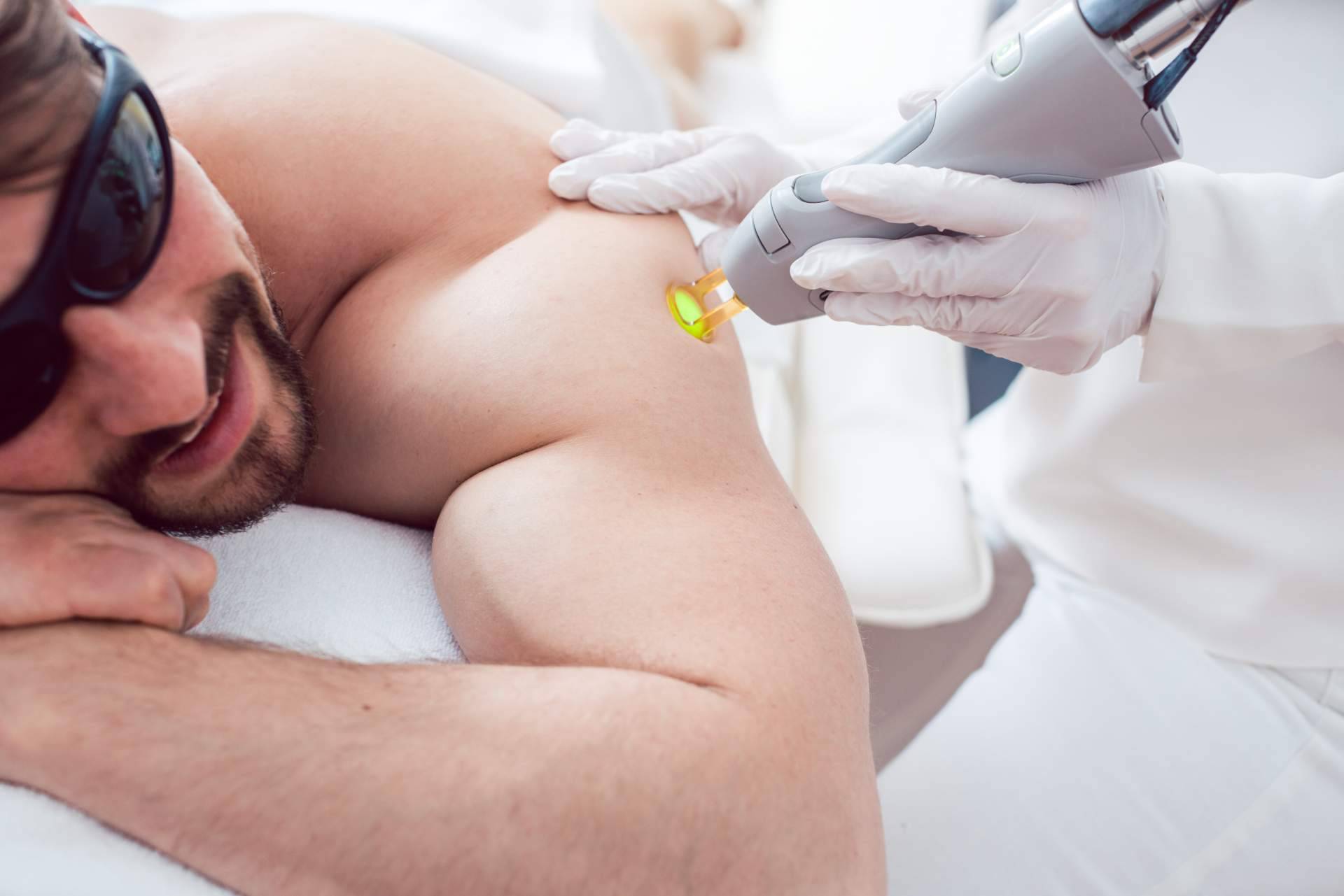 ¿Cuántas sesiones de láser se necesitan para eliminar el vello? Dermativa