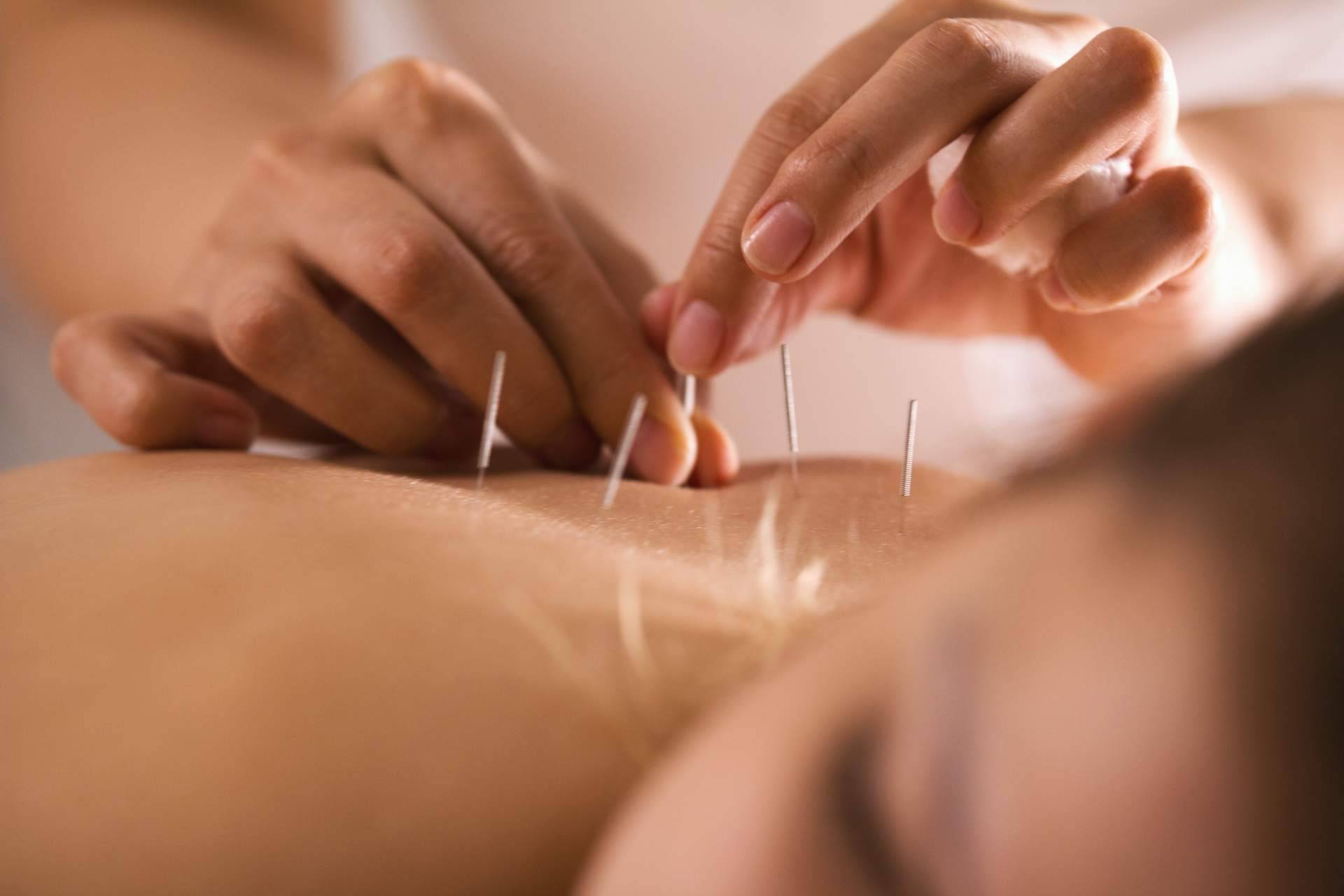 Trabajar de acupuntor y osteópata a través de una formación internacional profesional