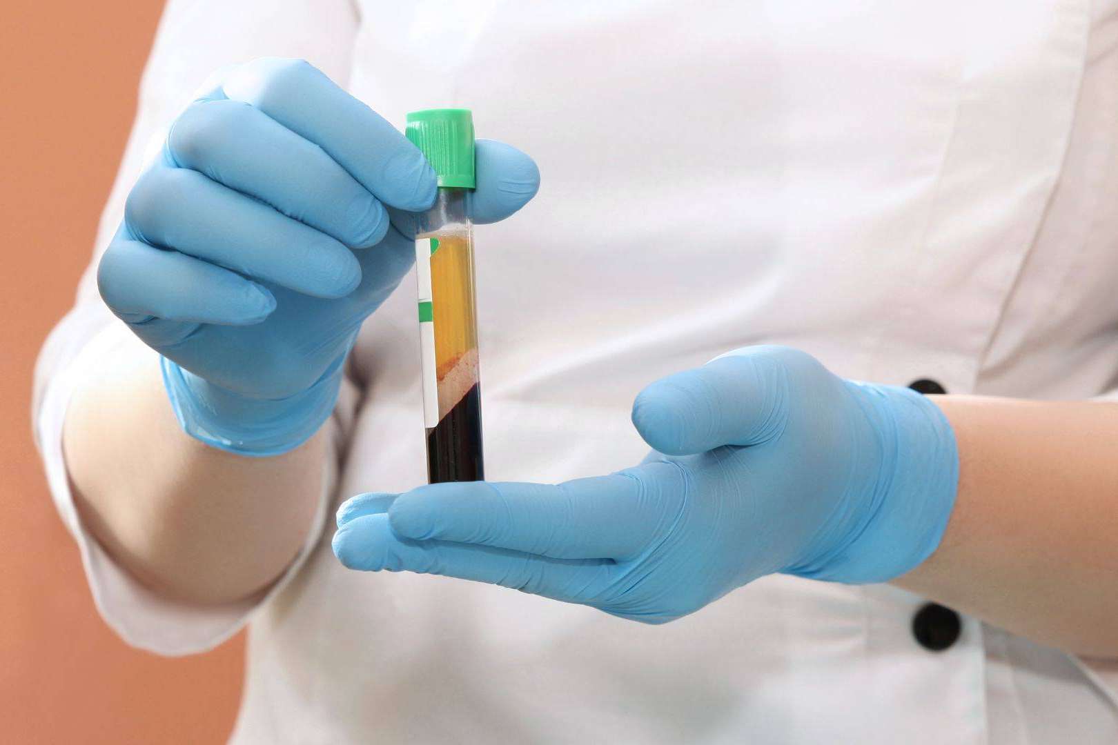 La potente terapia regenerativa de doble efecto basada en plasma rico en plaquetas y dutasterida contra la caída del cabello
