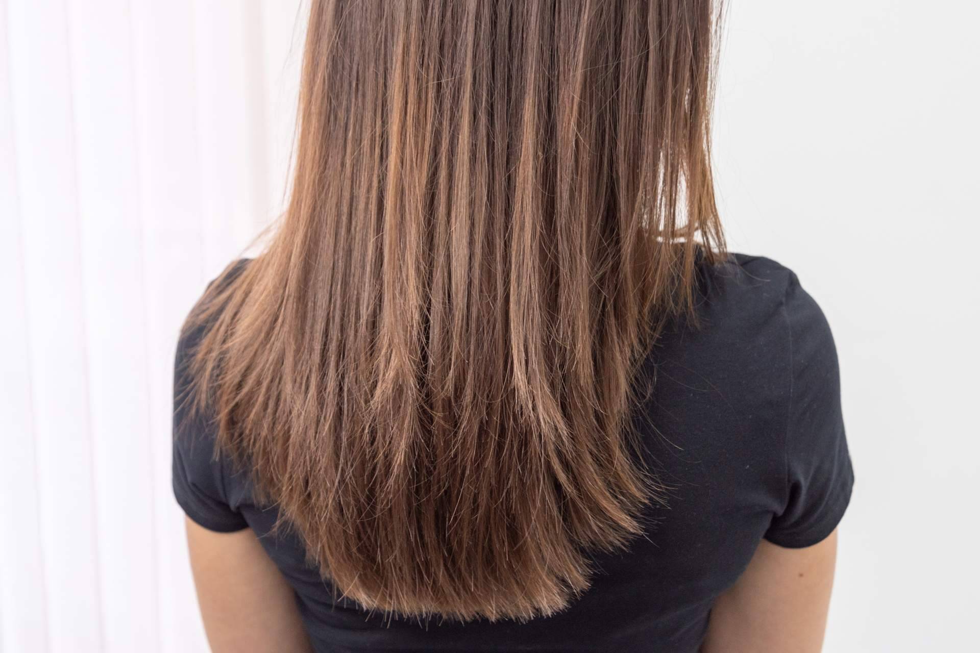 Tratar la alopecia e injerto capilar en mujeres, por MC360