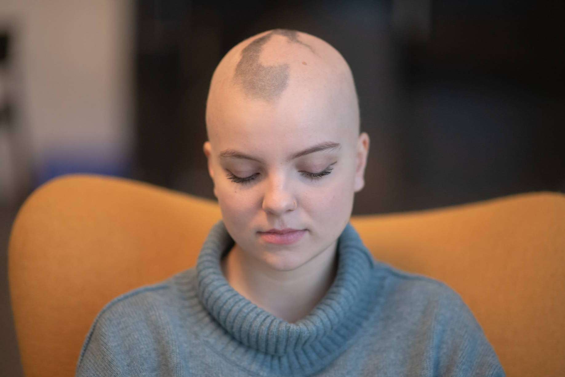 La alternativa a la pérdida de cabello, prótesis capilares
