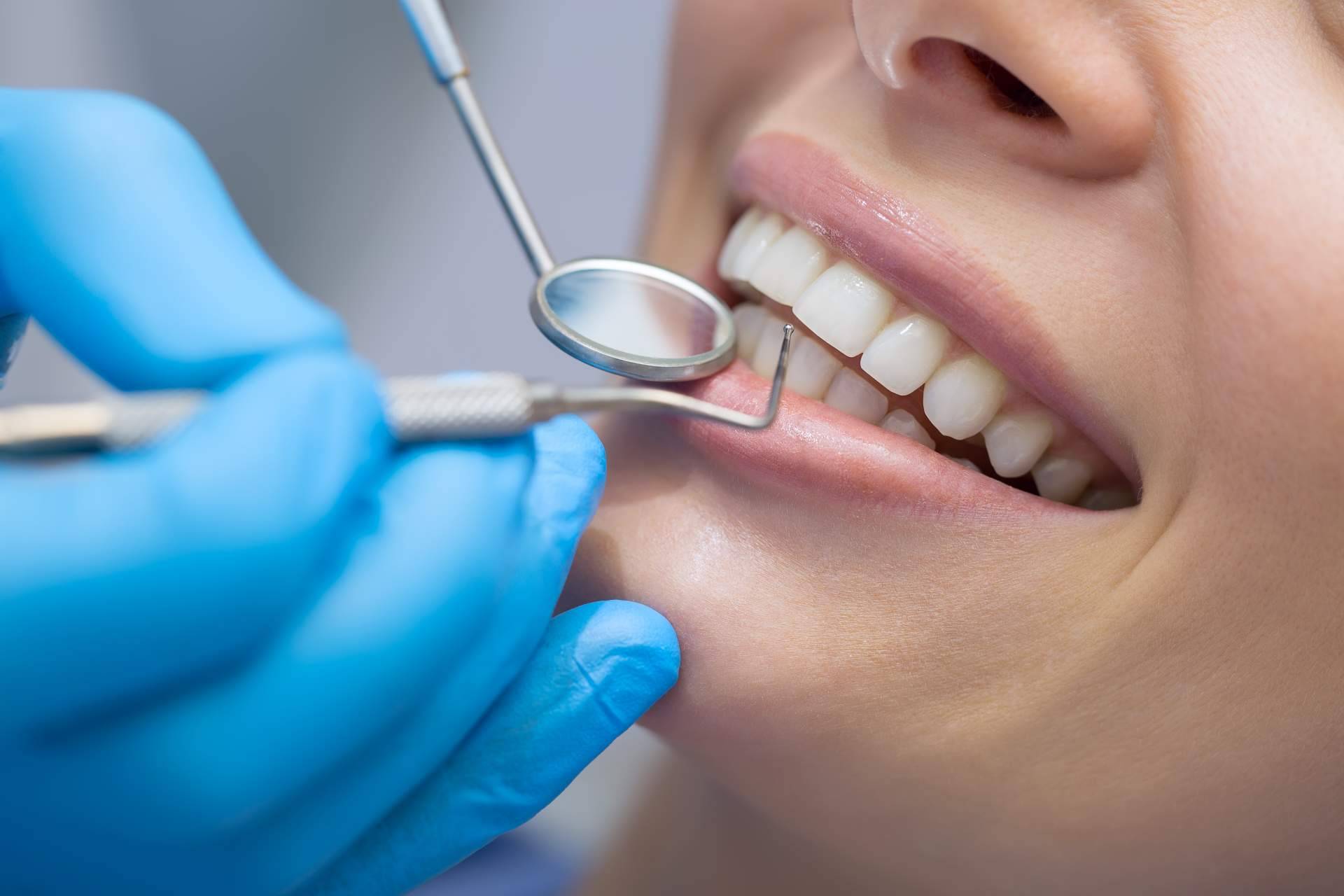 Sonrisa gingival, ¿cuándo es necesaria la cirugía ortognática?
