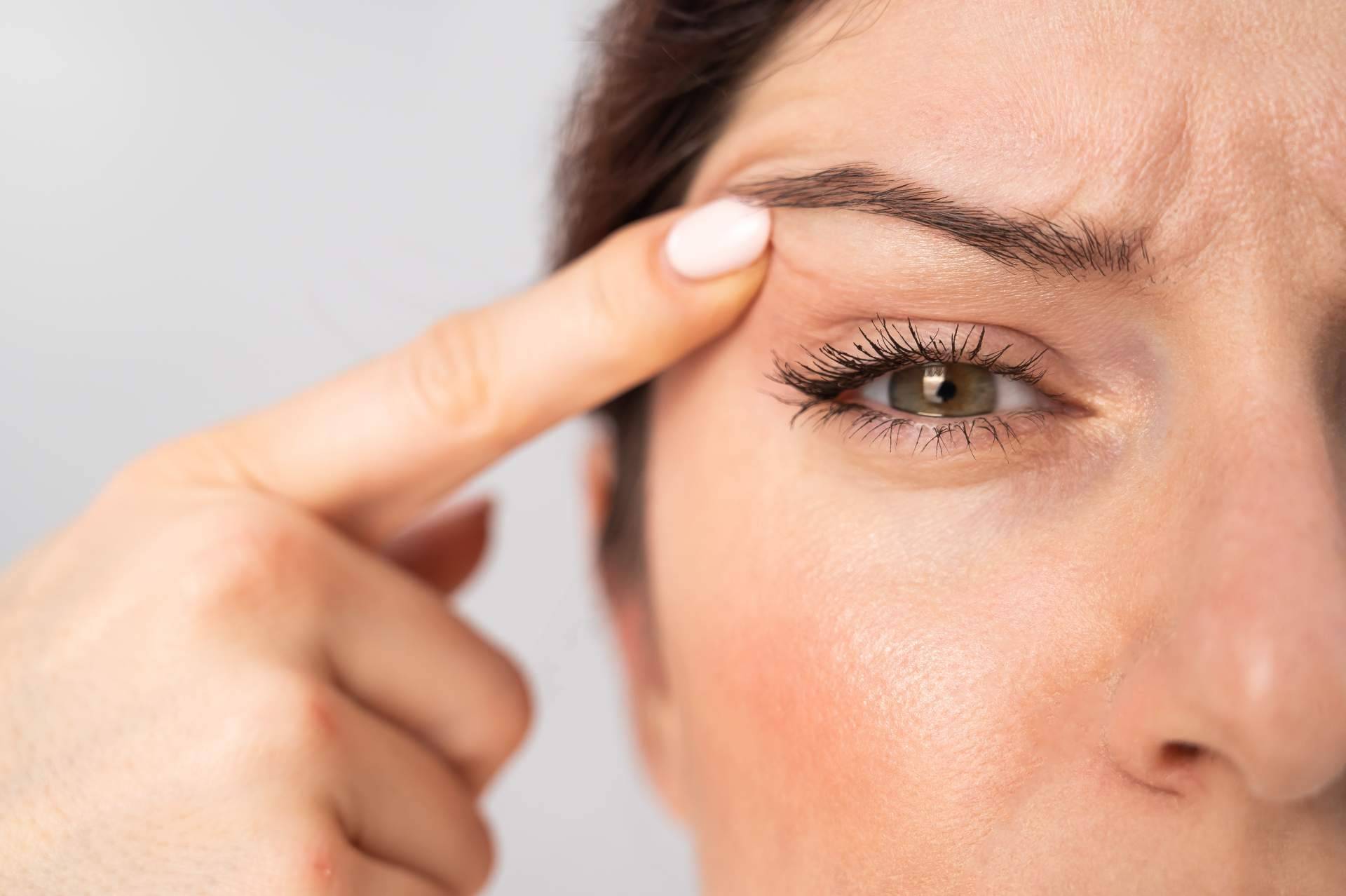 La blefaroplastia no quirúrgica de Alluring Clinic