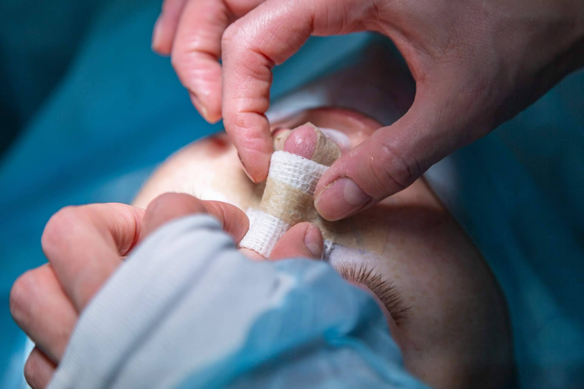 ¿Qué se debe saber sobre la rinoplastia?, por Clínica Calvo de Mora