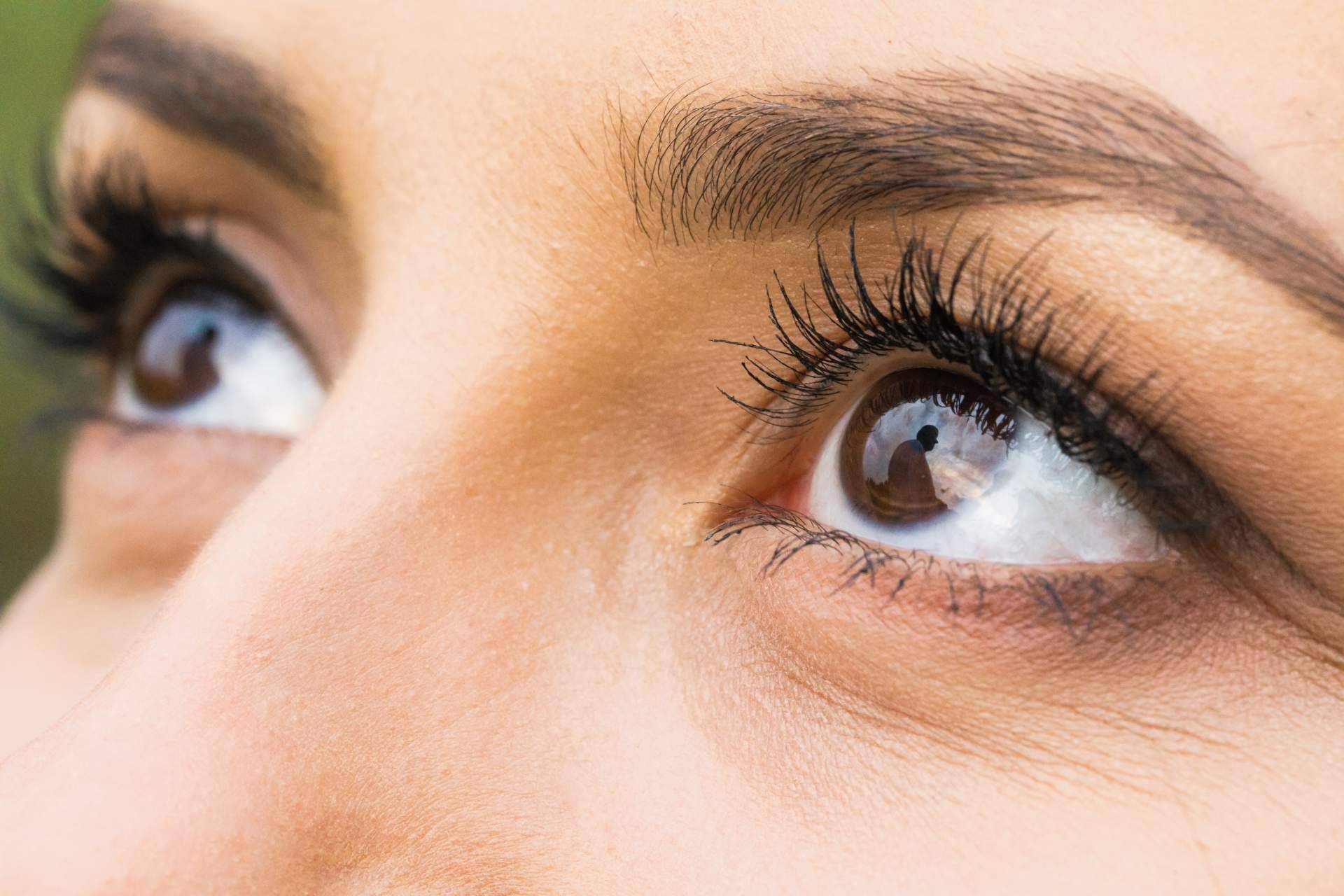 La tendencia de 'foxy eyes' en medicina estética para lograr una mirada cautivadora