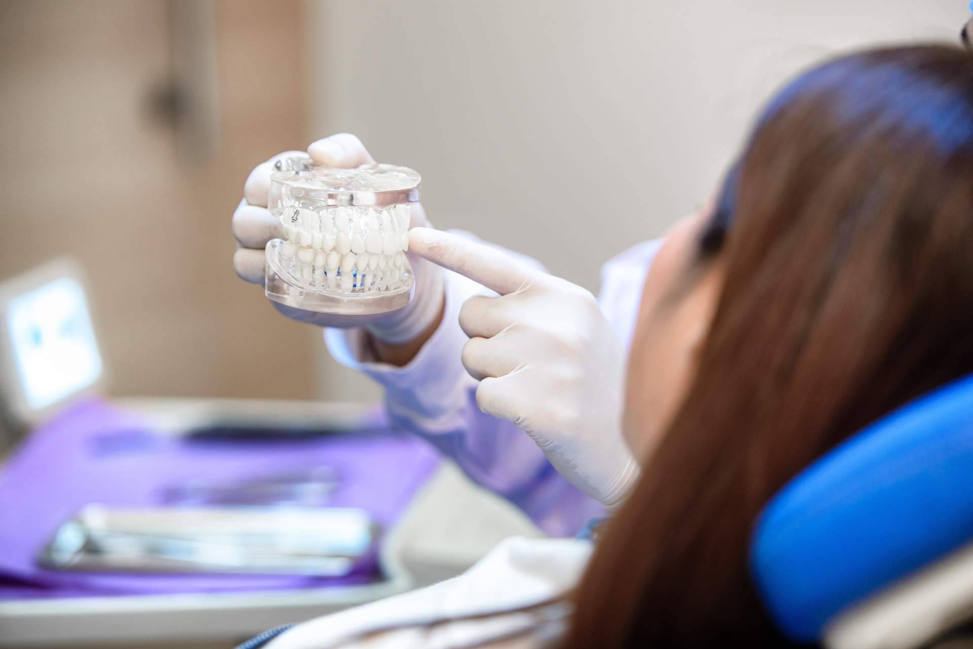 Los tipos de implantes dentales, por Bucalia