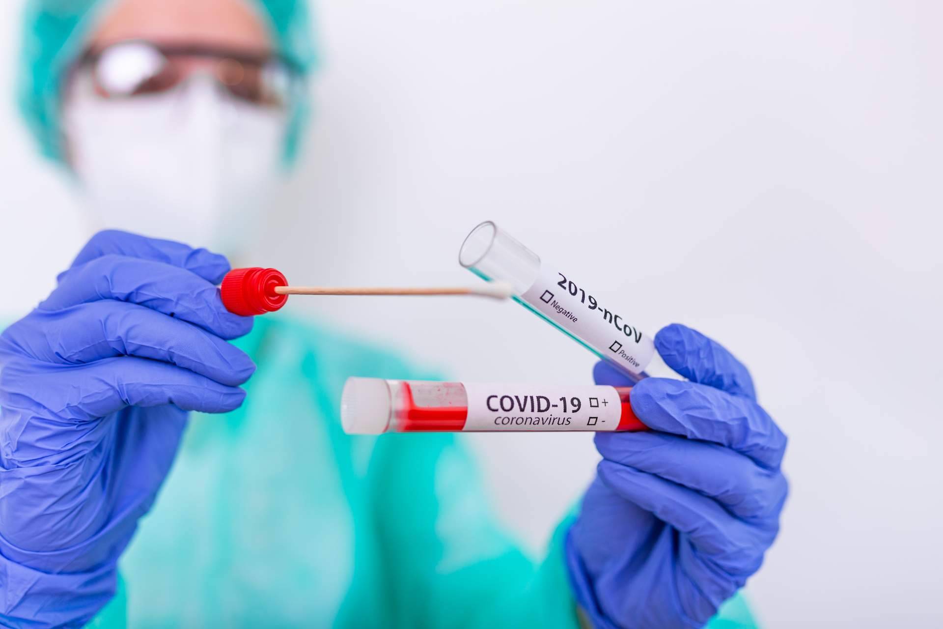 Realizar un test covid Madrid para estar tranquilo en las comidas y cenas con familiares, gracias a Centro Médico Bravo
