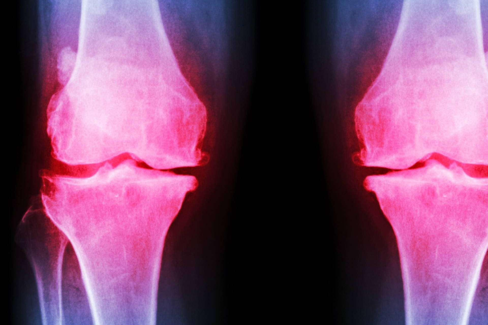 La clínica de fisioterapia avanzada que ayuda a encontrar respuestas a las personas que sufren dolor sin saber qué les sucede y en ocasiones es algo grave