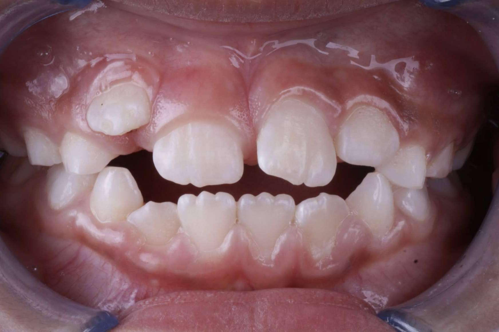 La Clínica Los Llanos Dental ofrece tratamientos de odontología infantil en Barcelona