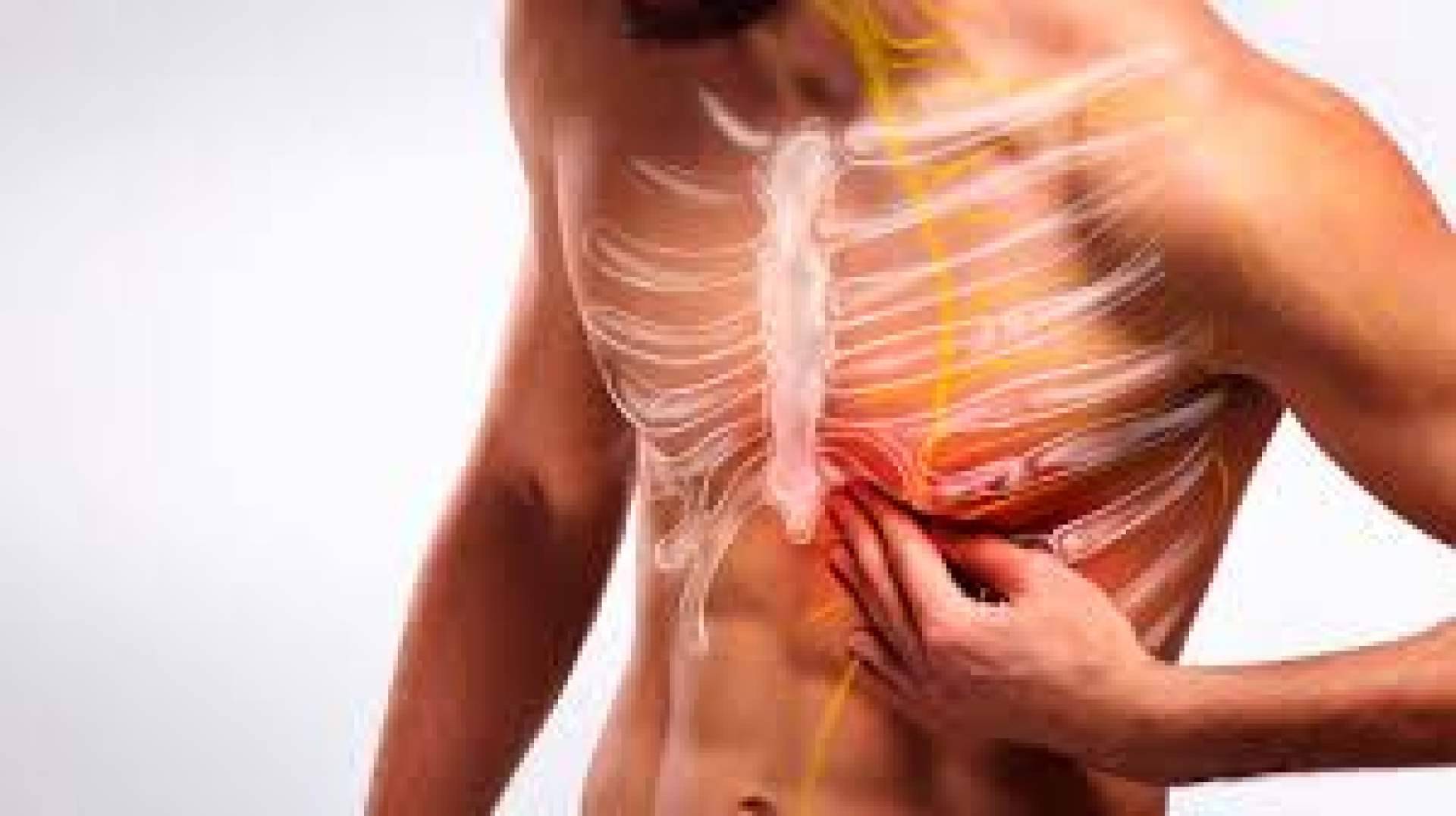 ¿En qué consiste el tratamiento para la neuritis intercostal de Centro Norteamericano Quiropráctico?
