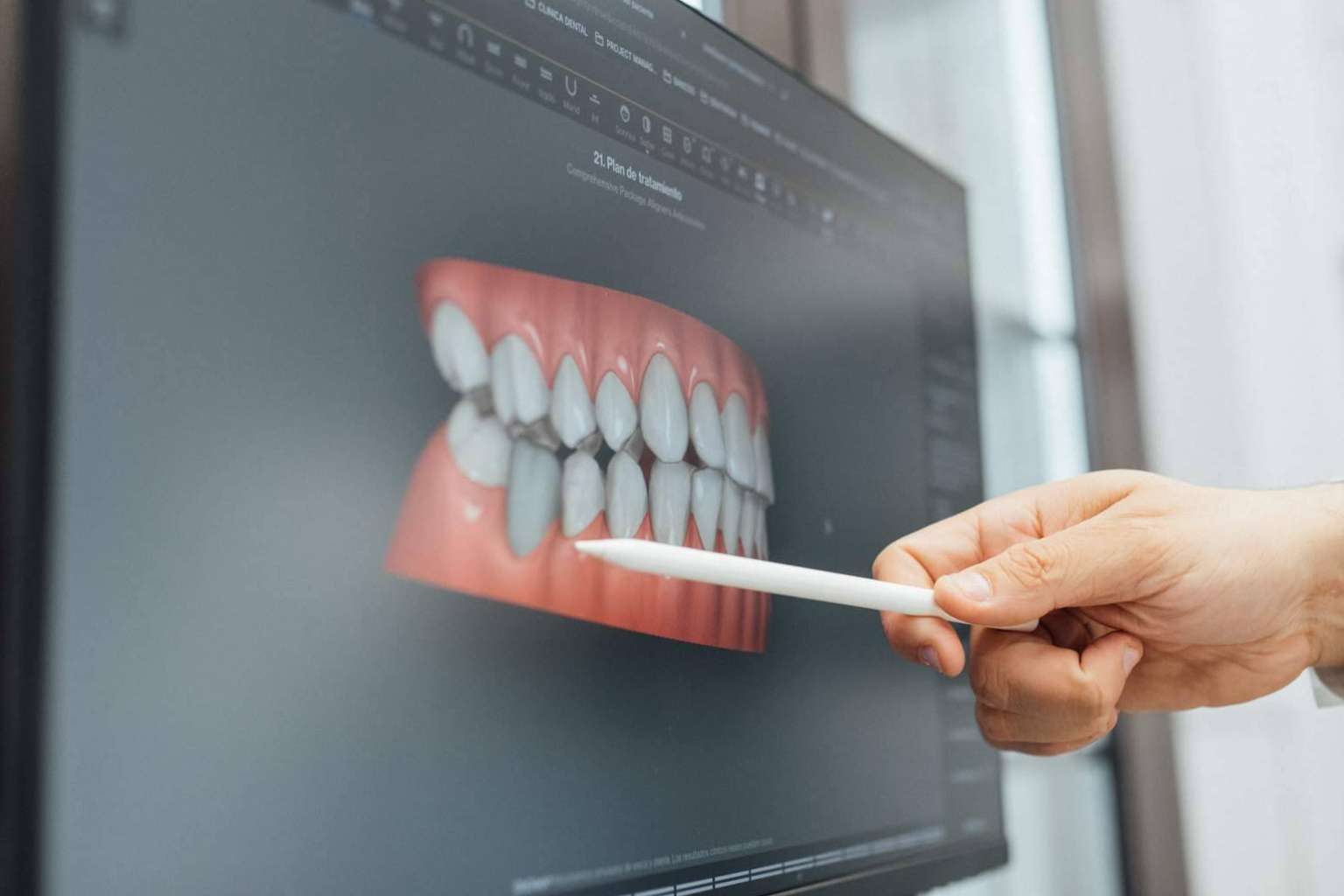 Todo lo que hay que saber acerca de la ortodoncia invisible en Barcelona, con Clínica Dental Claris