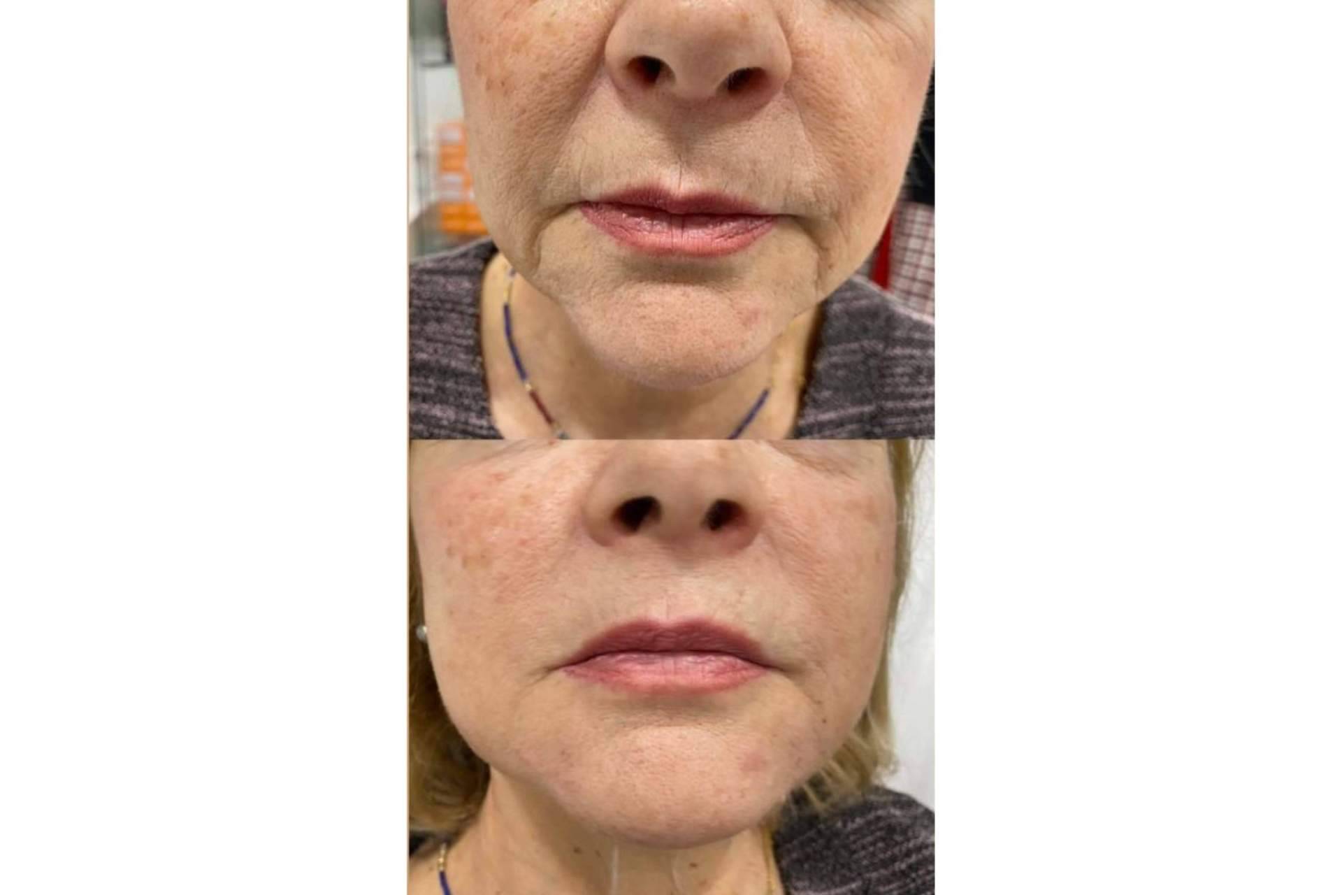 El tratamiento facial completo para mejorar el aspecto de la piel de Clínica Amalfi