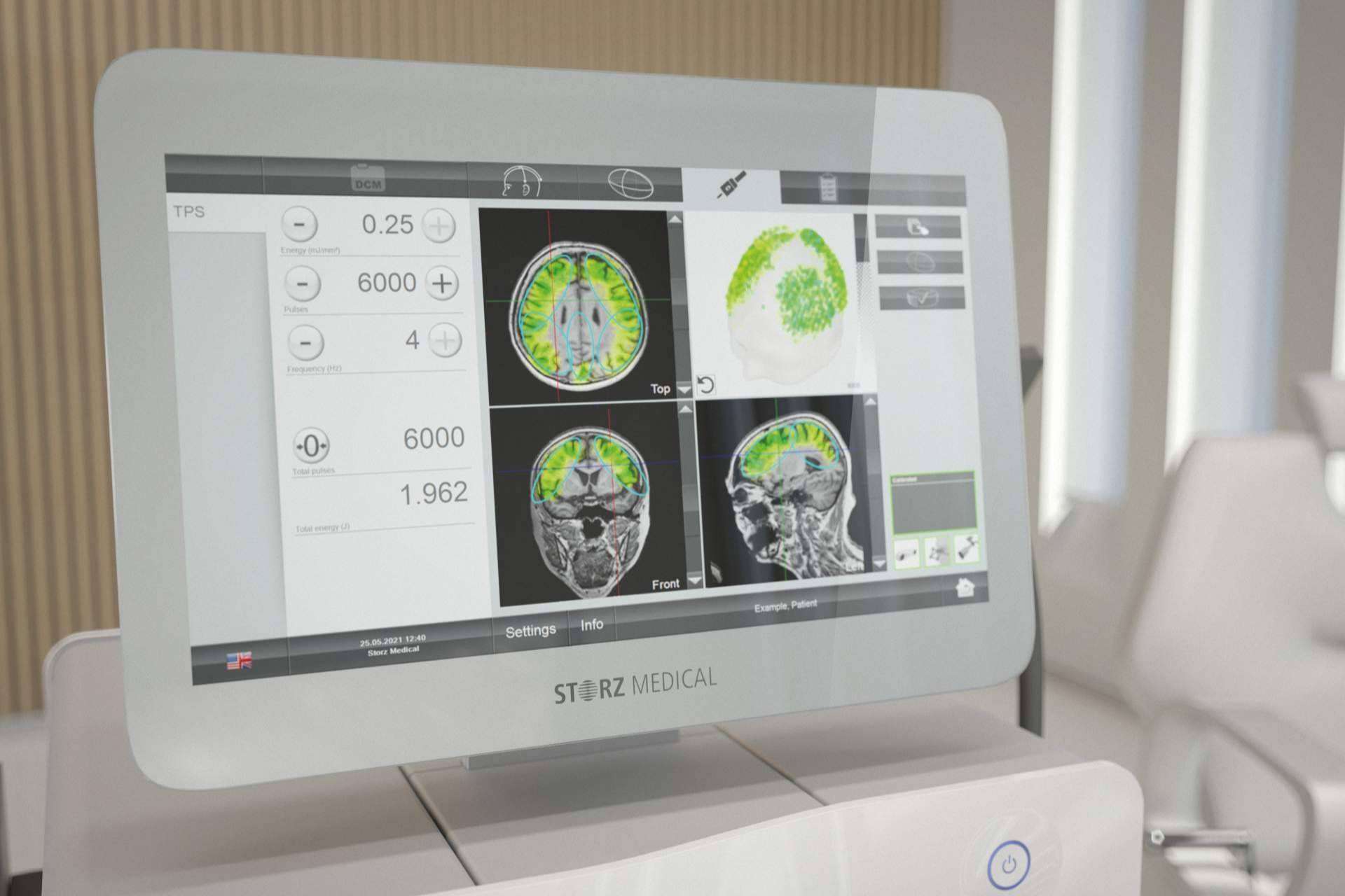 Tratamiento del Alzheimer en fase temprana; innovación en Clínica DKF