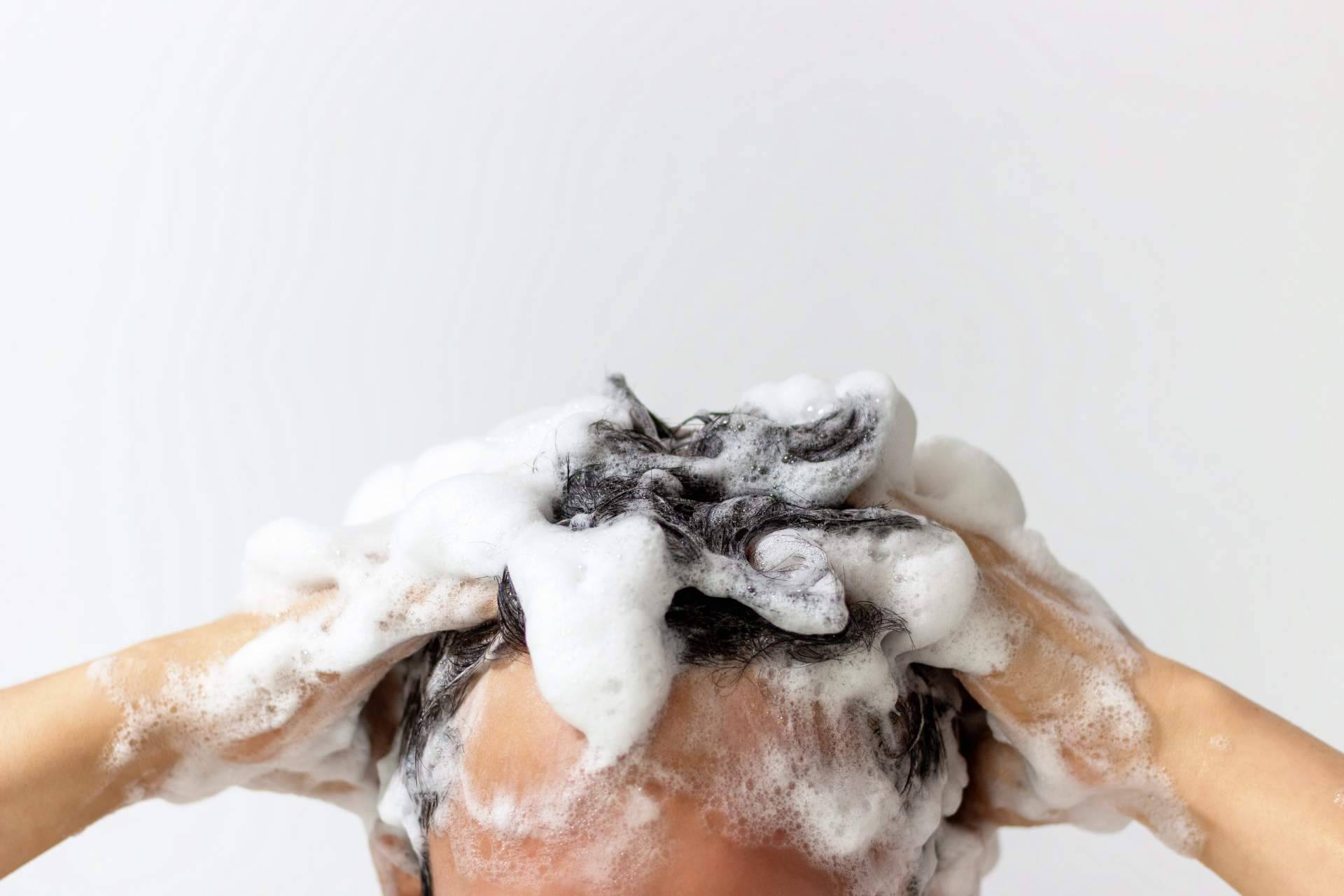 ¿Cómo lavar el cabello tras un trasplante capilar? El champú de Evocapil tiene la solución