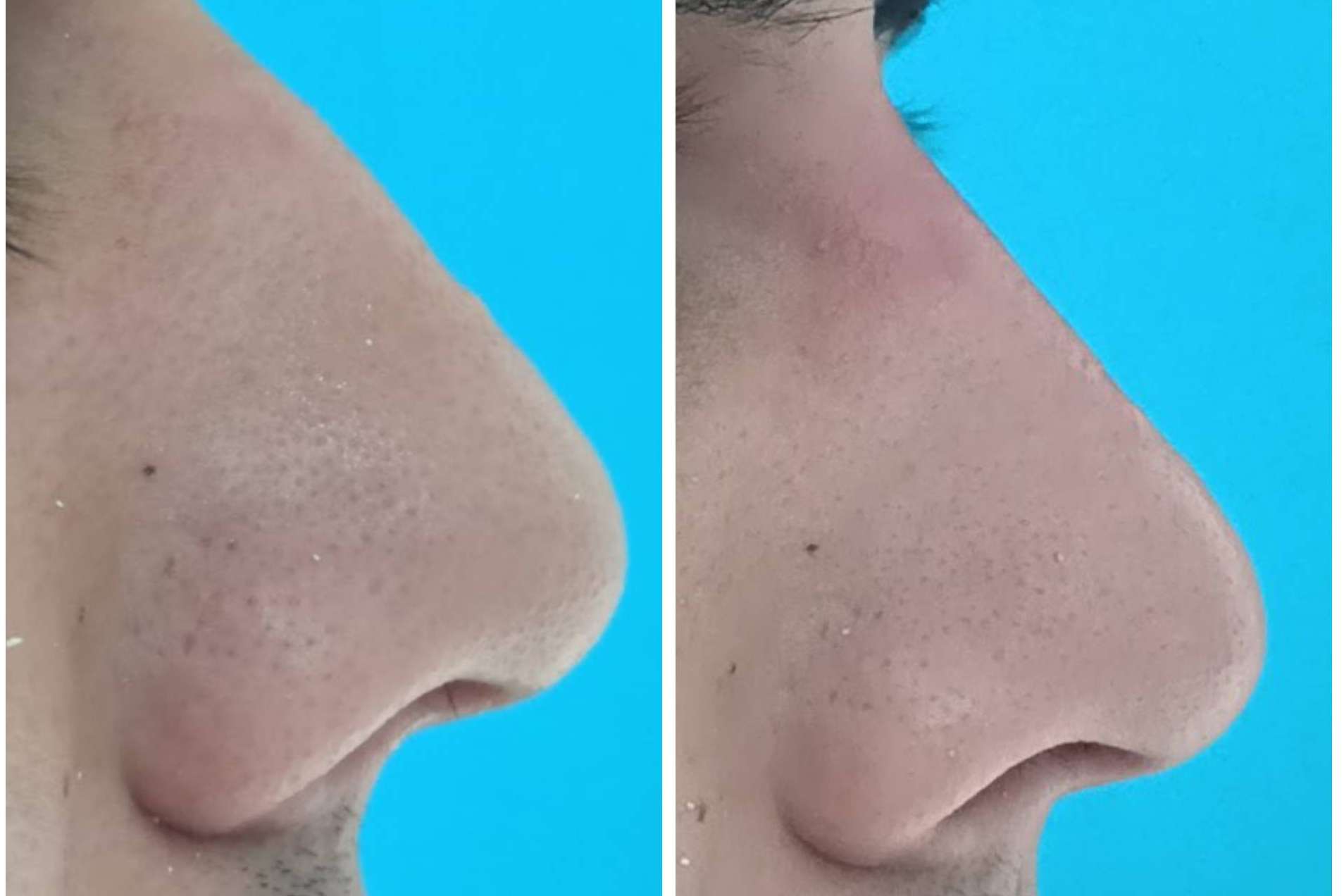 Medicina estética facial y dental para una sonrisa perfecta, con Clínica Calvo de Mora