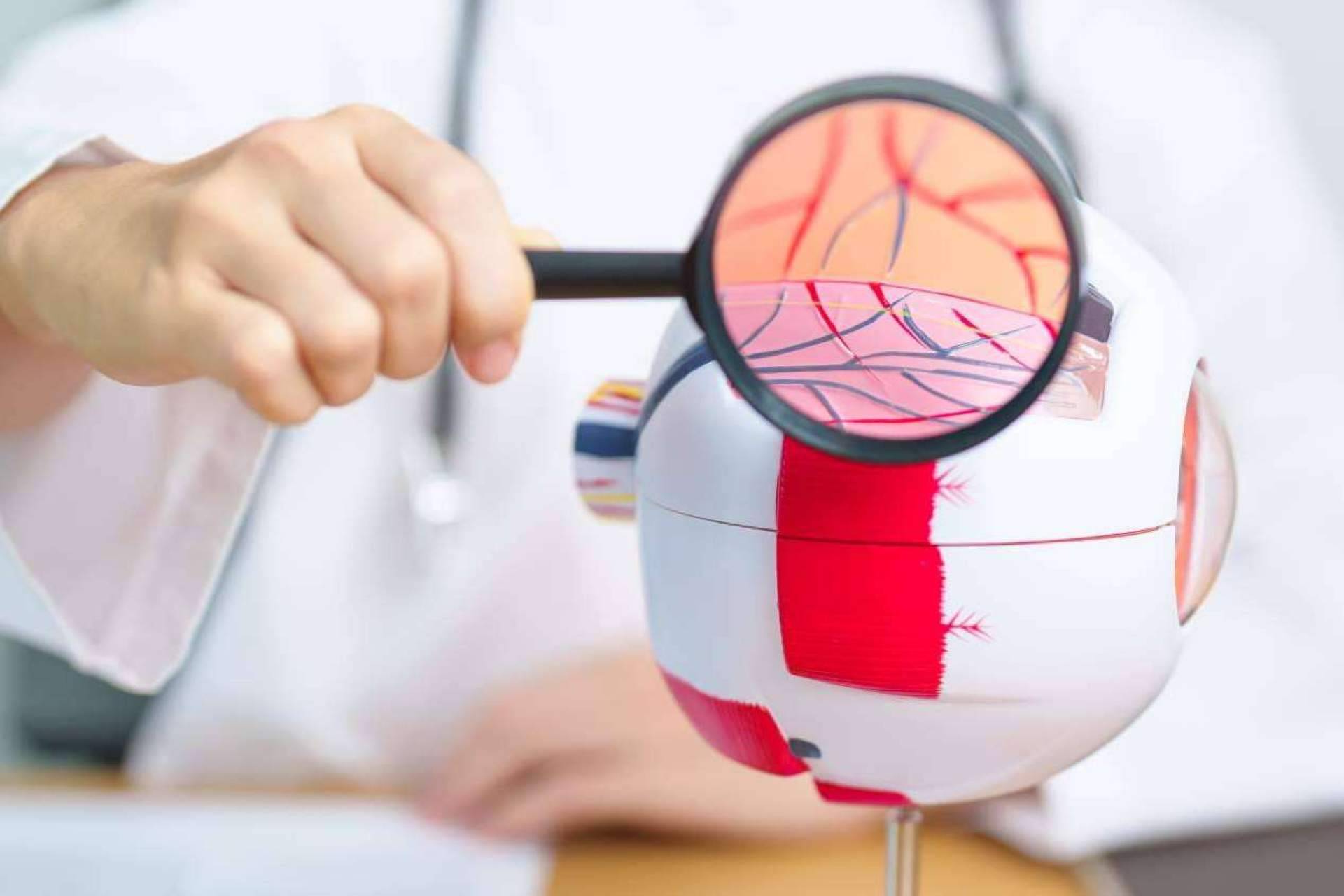 El Departamento de Oftalmología del Instituto Universitario Dexeus habla sobre la retinopatía diabética