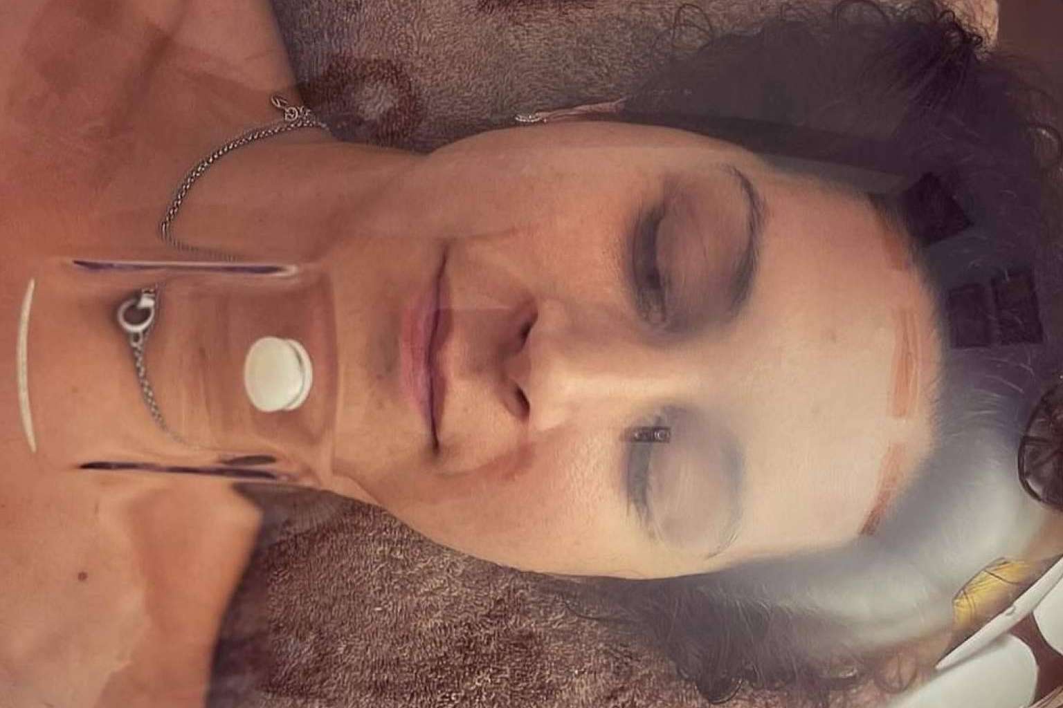 Oxigenoterapia facial con cúpula hiperbárica, el secreto para una piel joven