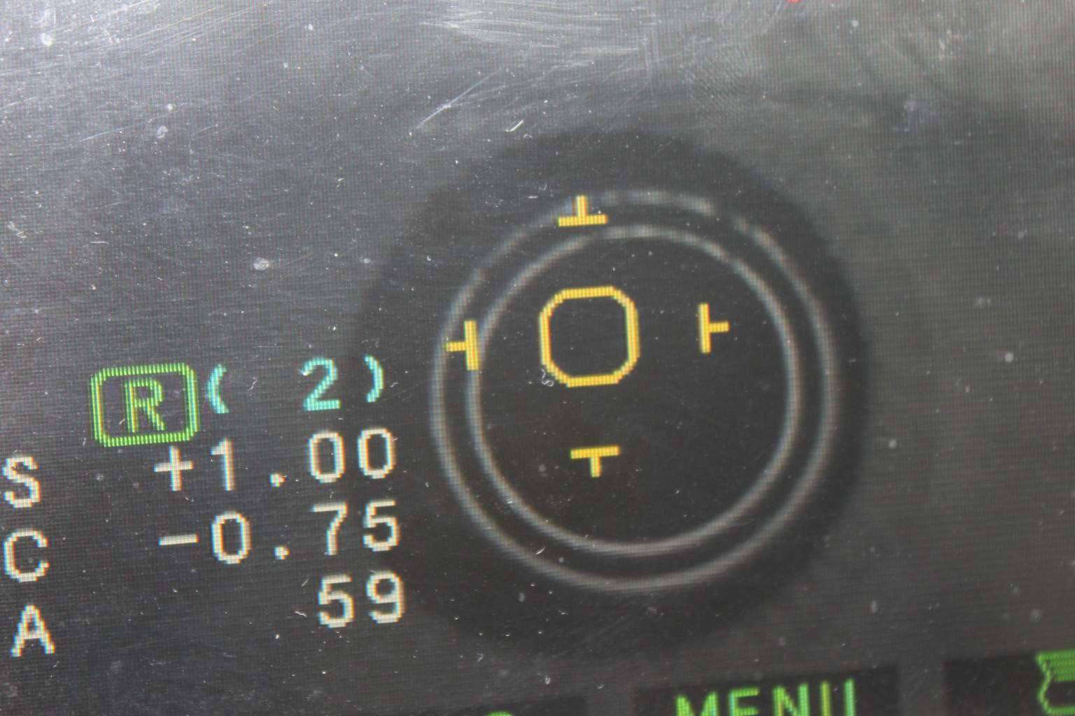 Cuidado con la visión durante los largos viajes de verano