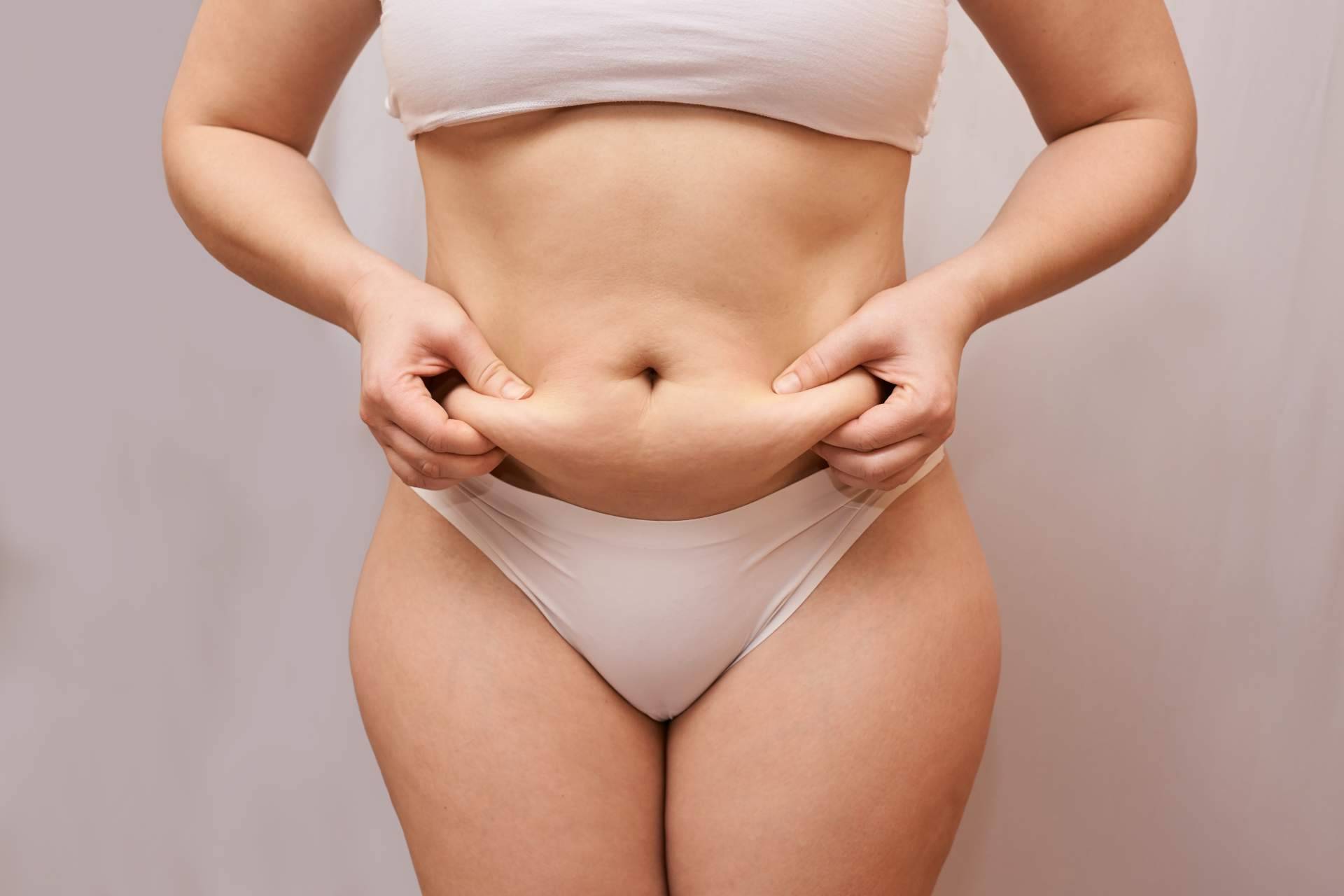 La abdominoplastia, una solución para eliminar la barriga y recuperar el vientre plano tras un embarazo
