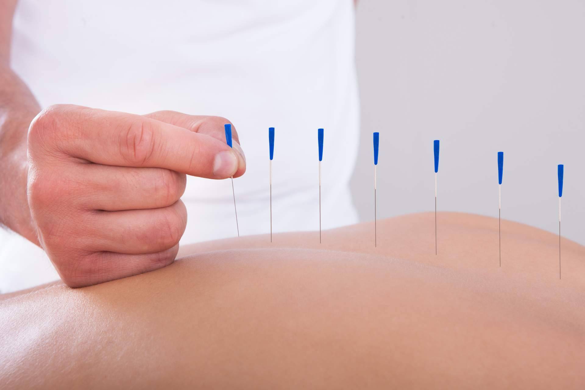 Vital Balance, una clínica de referencia en acupuntura en Málaga