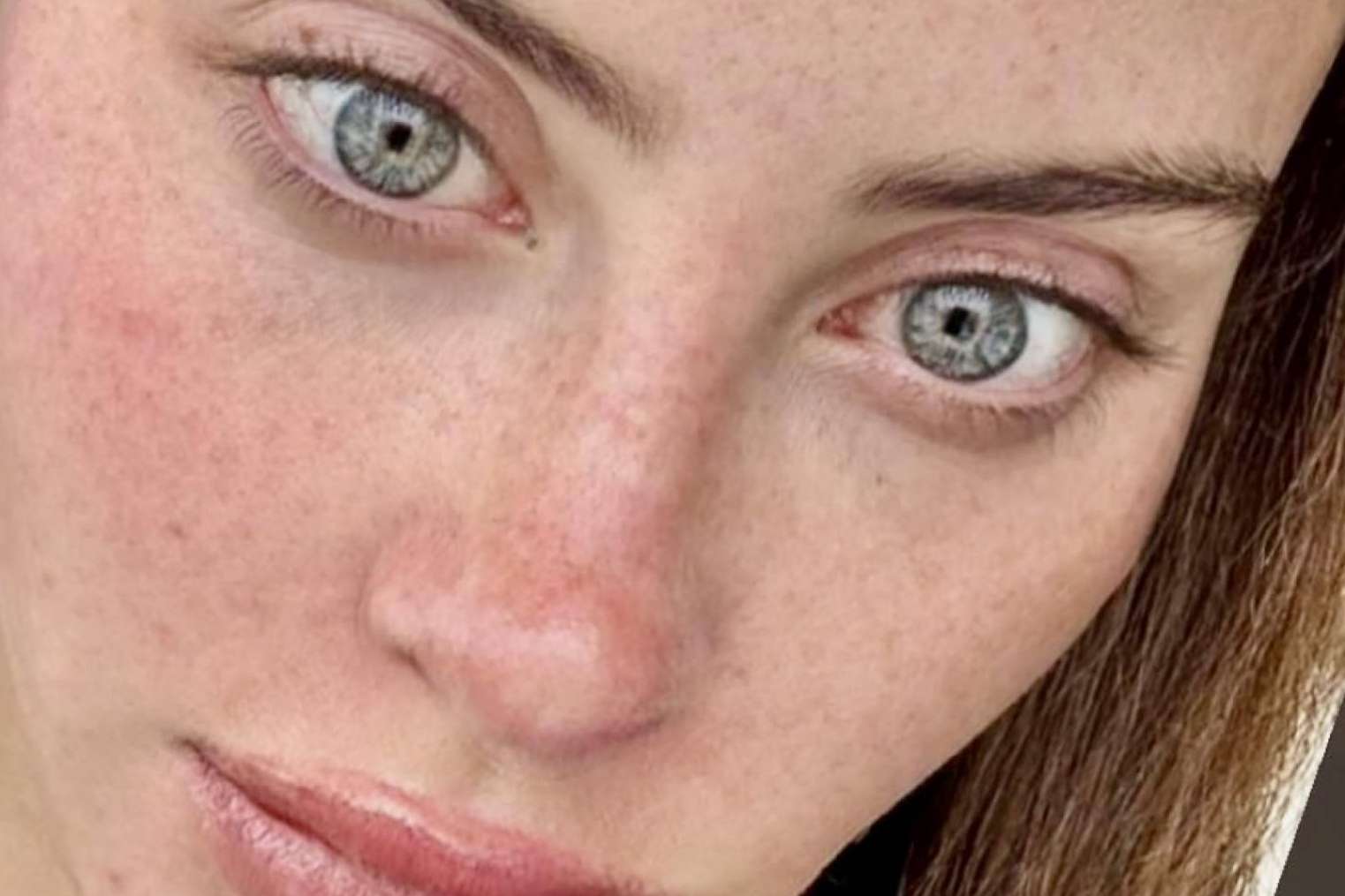 Eyecos ofrece tratamientos de estética facial avanzados para rejuvenecer y cuidar la piel