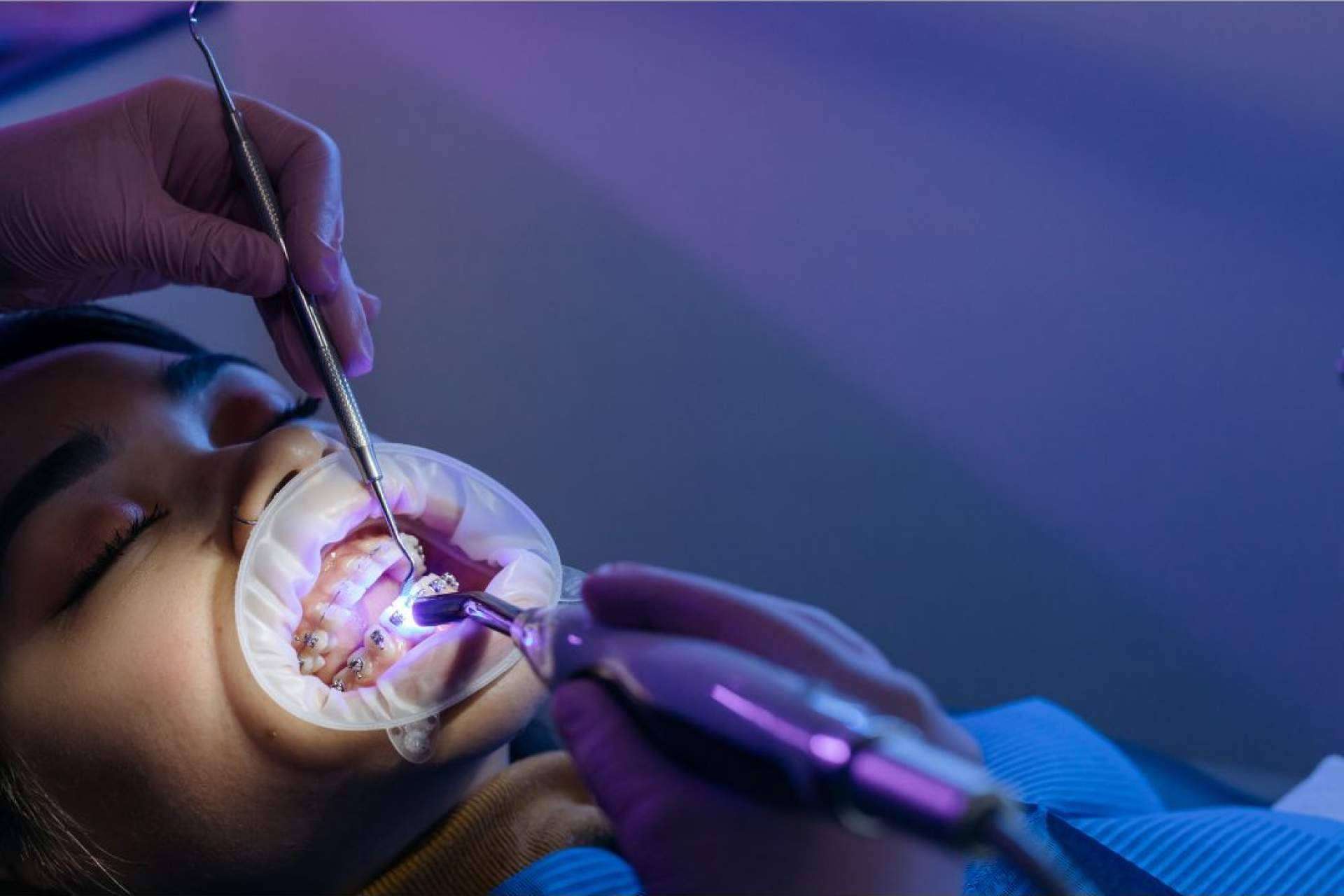 Tratamientos odontológicos asequibles en Madrid con la garantía de Denty Dent