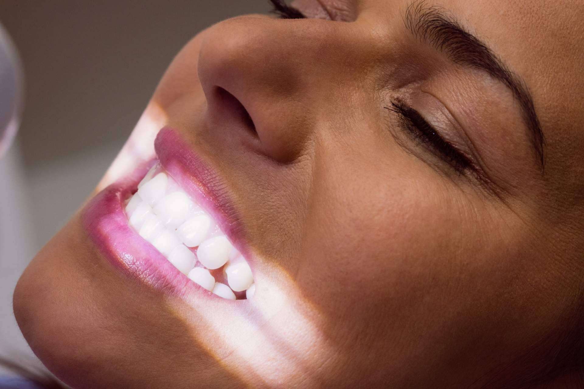 El blanqueamiento dental más exclusivo de Madrid, ahora al 50% en Clínica Calvo de Mora